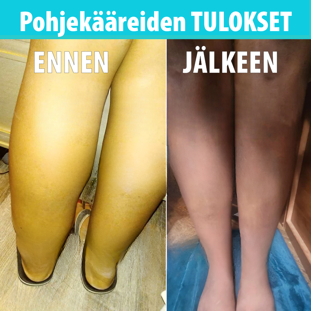 Säärikompressiokääre