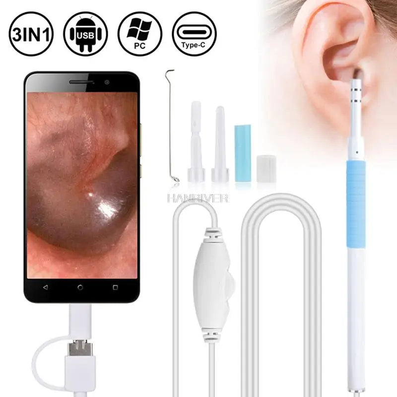 Smart Ear Explorer – Näe ja puhdista korvasi turvallisesti kameran avulla